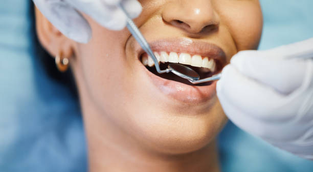 Best Emergency Gum Pain Relief  in West End Cobb Town, AL